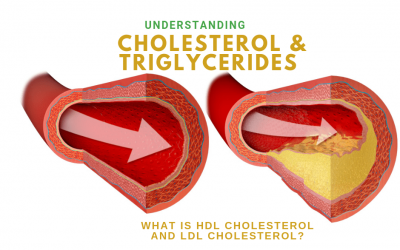 Understanding Cholesterol, Triglycerides, HDL Cholesterol and LDL Cholesterol