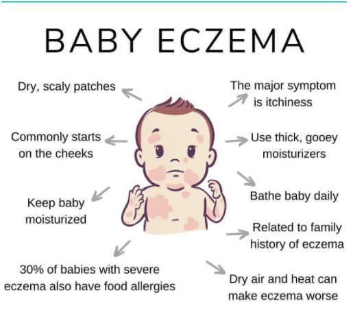 Eczema Treatment