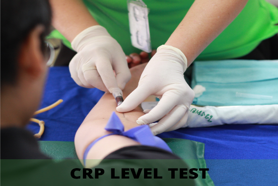 CRP level test